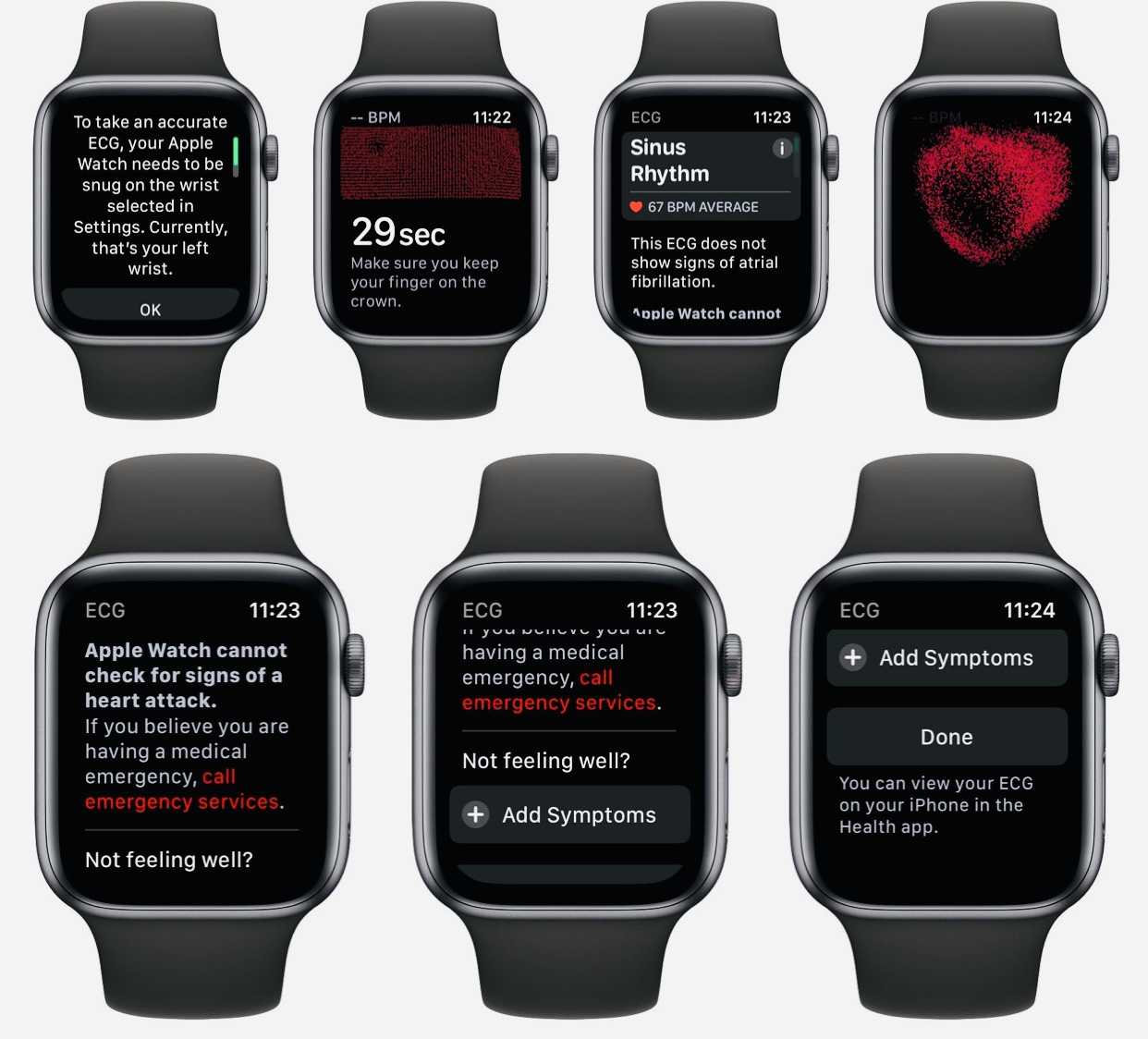 Что значит watch call на часах. Кардиограмма на Эппл вотч. Часы эпл вотч. Apple watch 7 ECG. Кардиограмма в АПЛ вотч.