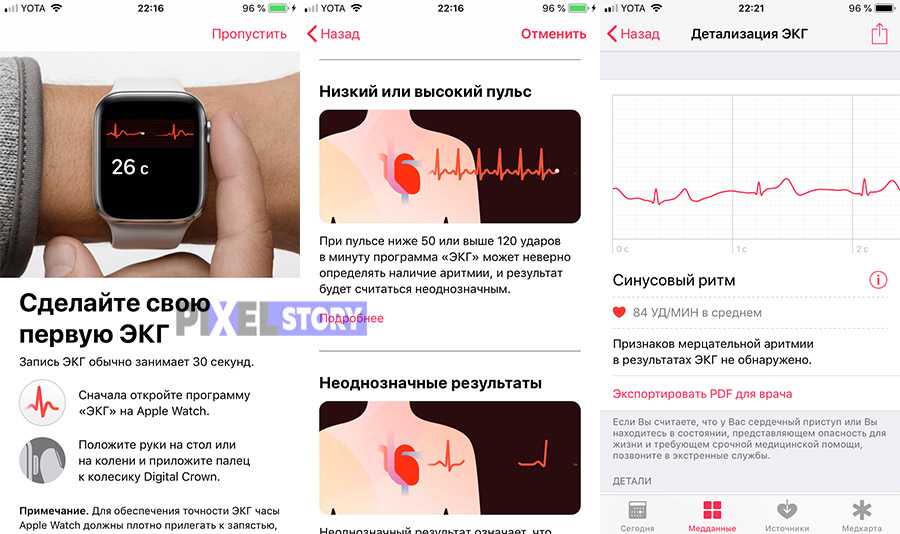 Подключение и настройка apple watch к iphone: правила синхронизации устройств